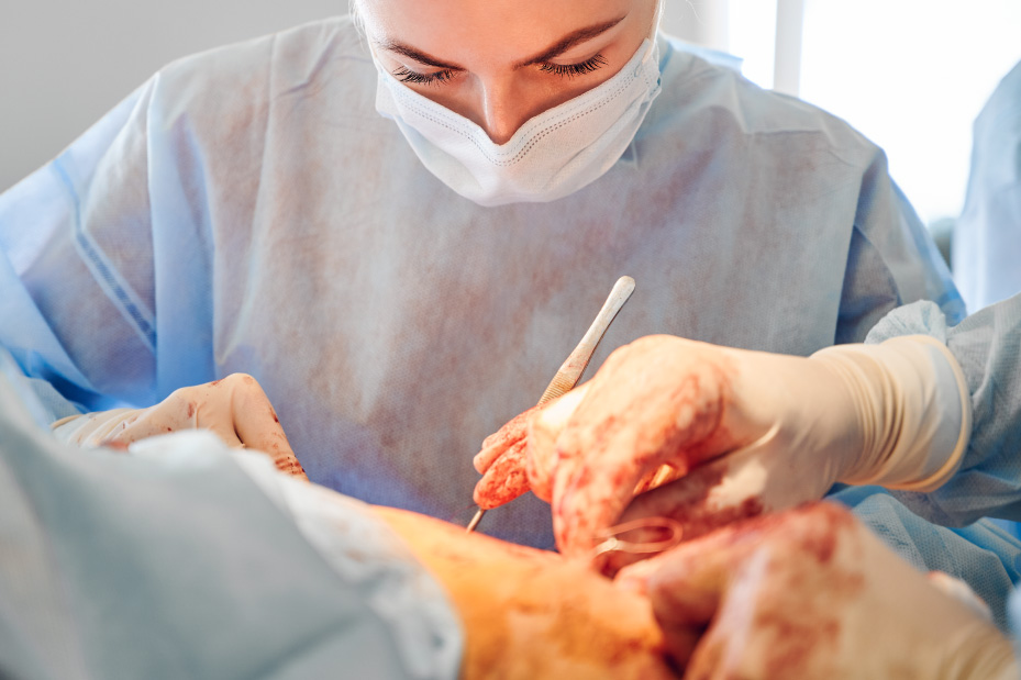 Desafíos quirúrgicos: fístulas y cirugía reconstructiva
